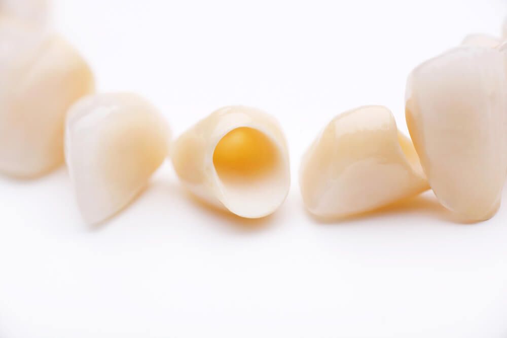 Close-up of several prosthetic teeth isolated on white background