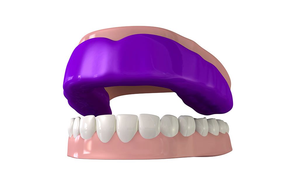 Mouthguards 3D image