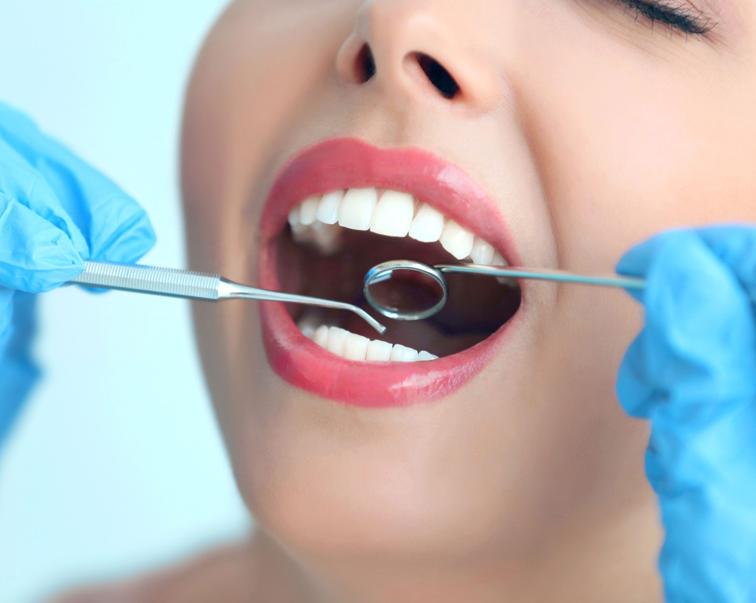 Woman with beautiful teeth getting dental exam
