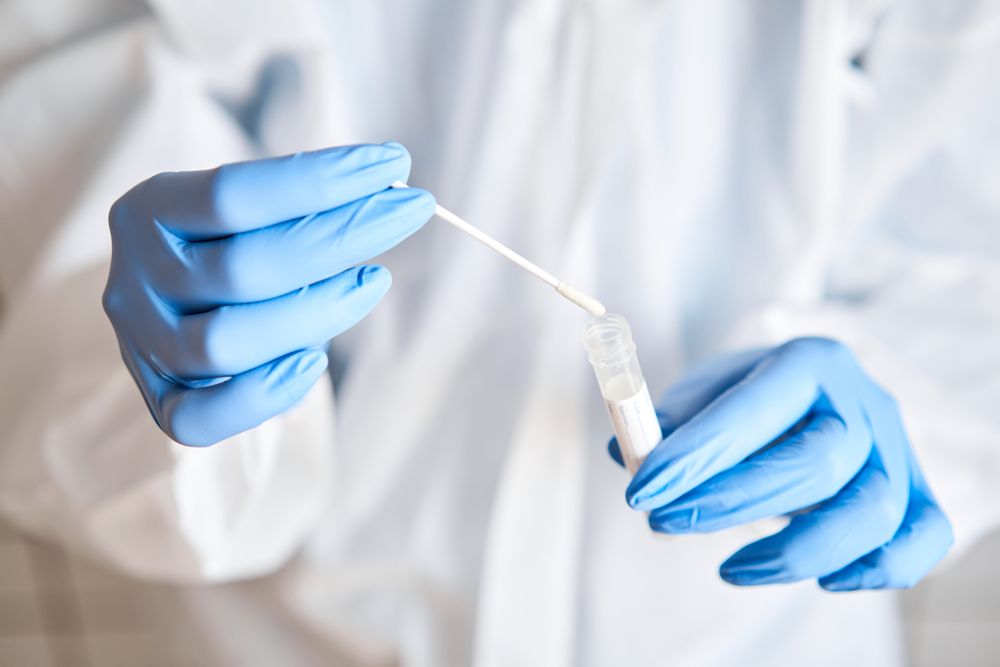 Doctor Holding Swab Test Tube