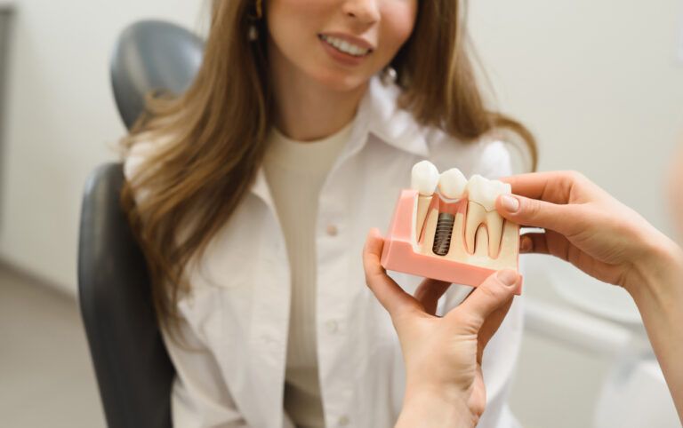 The dentist shows a model of a dental implant to female patient