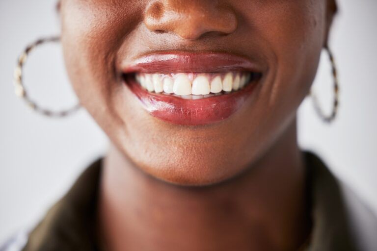 Woman with white healthy teeth smiling