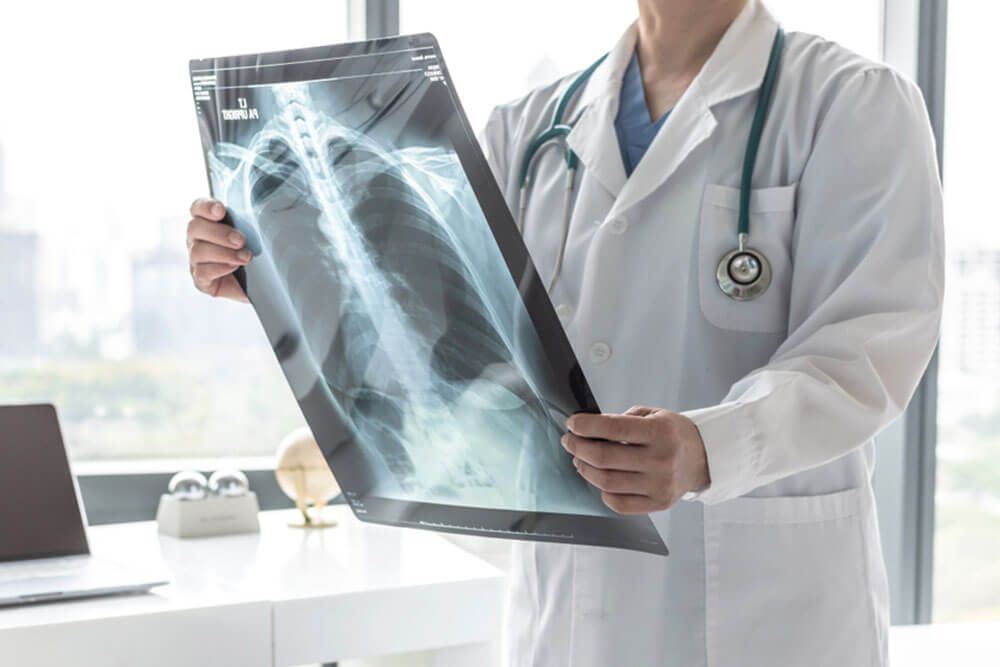 Doctor with radiological chest x-ray film for medical diagnosis