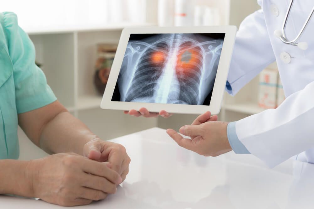 doctor explaining results of lung check up from x-ray