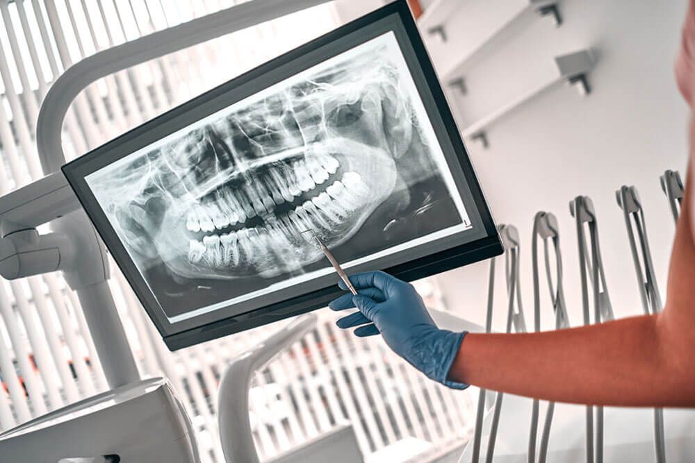 Image of doctor or dentist presenting with tooth x-ray