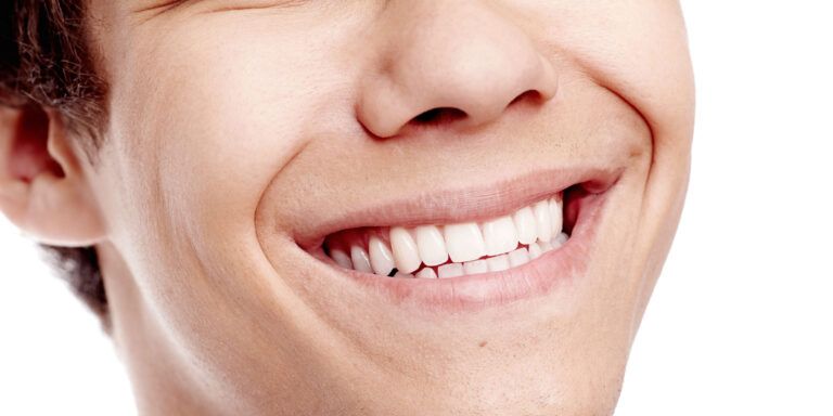 young man smiling with perfect healthy white teeth