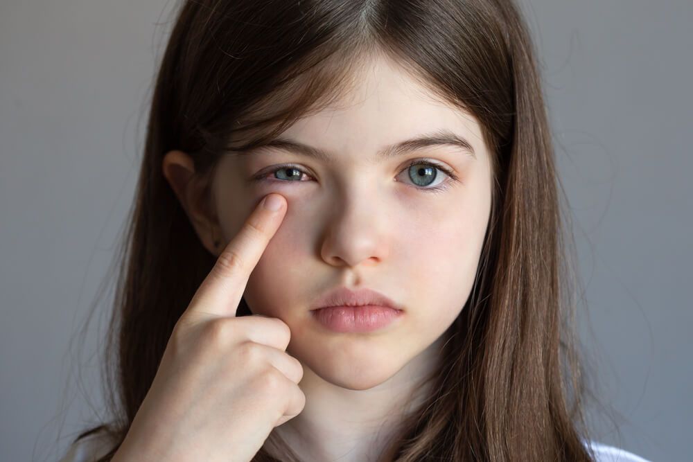 a little girl has an Eye Infection