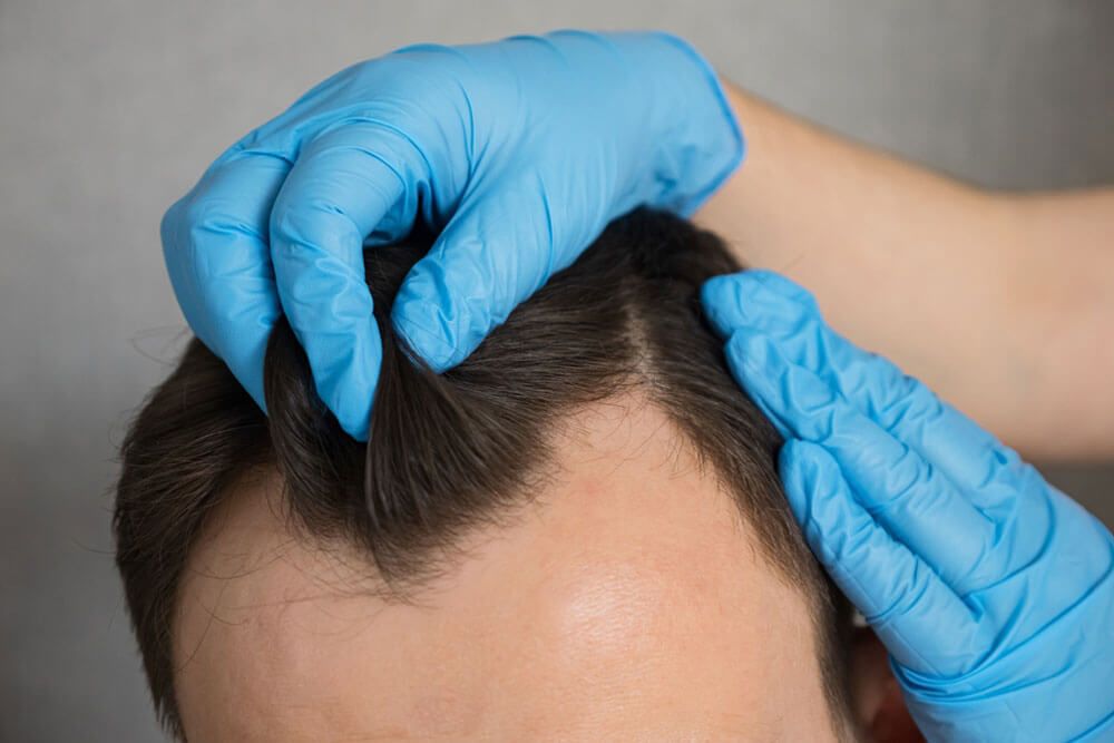 Doctor in rubber gloves doing checkup of hair of man