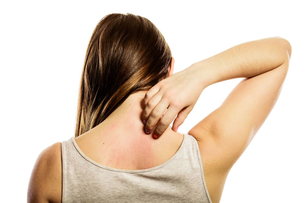 Young woman scratching her itchy back with allergy rash