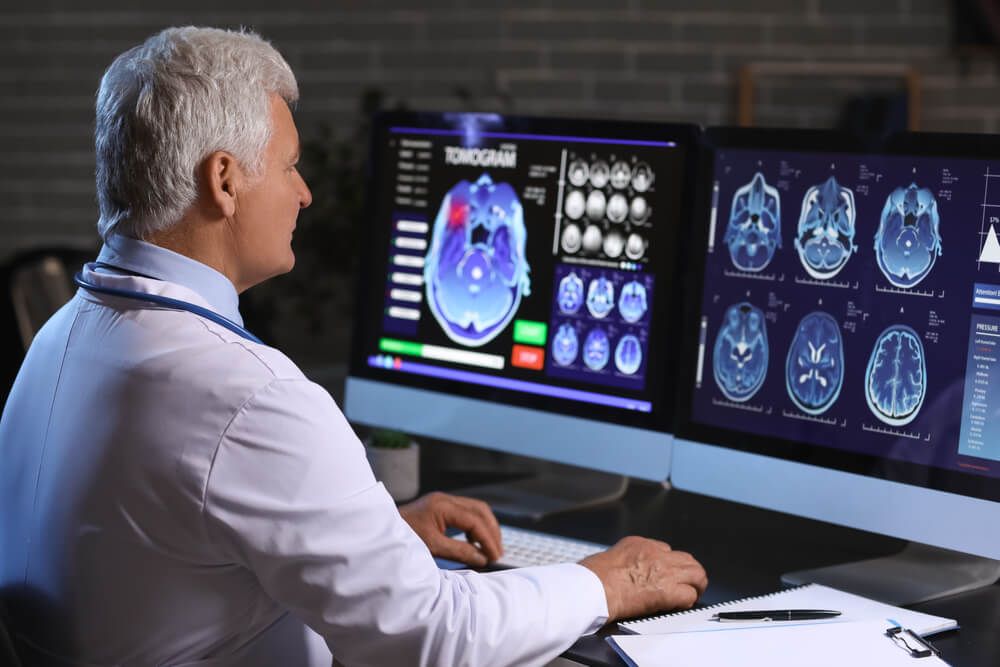 Senior neurologist with MRI scan of human head