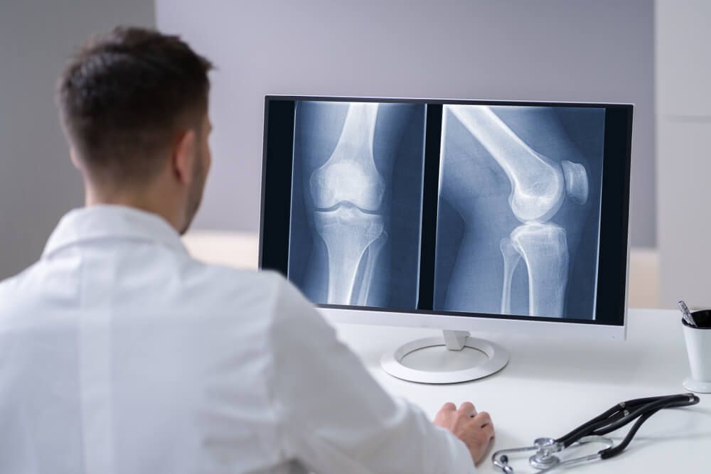 Mature Male Doctor Examining Knee X-ray In Clinic