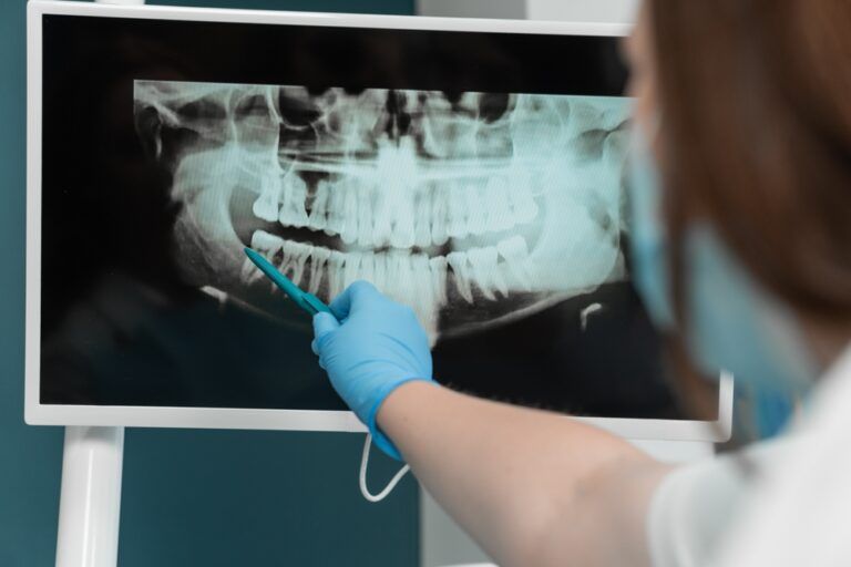 Importance of Dental XRays Beausejour Dental Centre Dr. Griffin