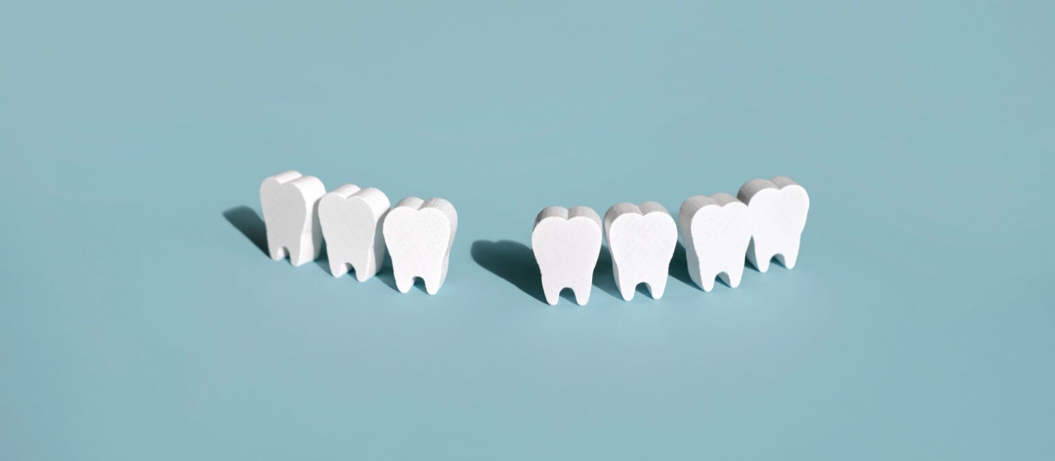 Dental Extraction Advanced Endodontic Specialists