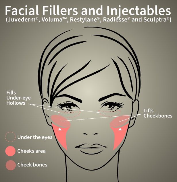Facial Fillers and Injectables illustration