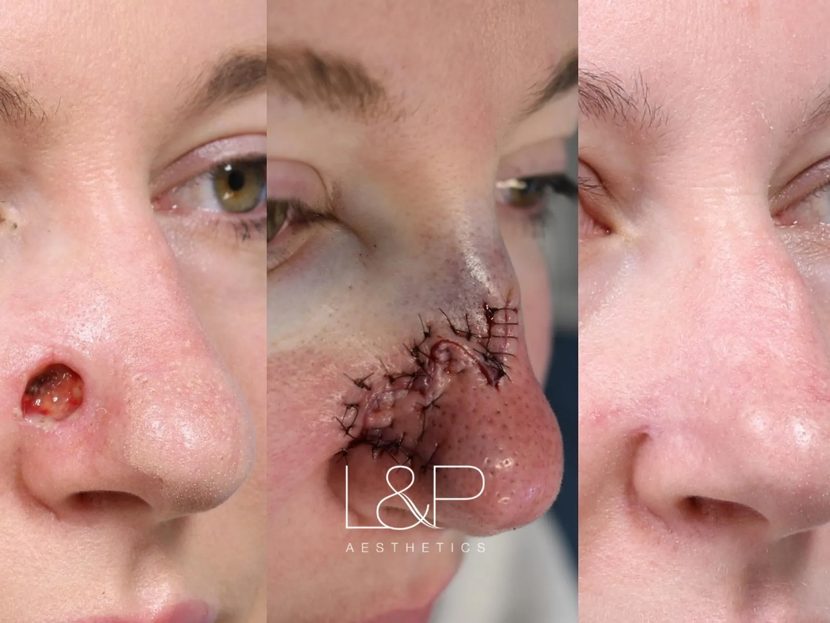 Reconstructive Surgery before and after treatment