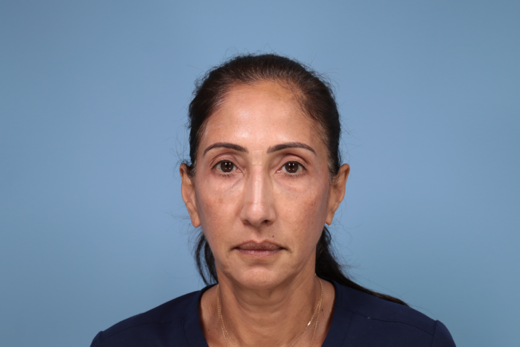 Front photo of a woman at L&P