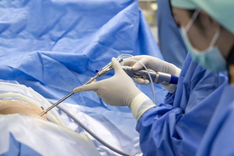 Team of doctor or surgeon and nurse in blue gown inside operating room did minimal invasive spine surgery technology