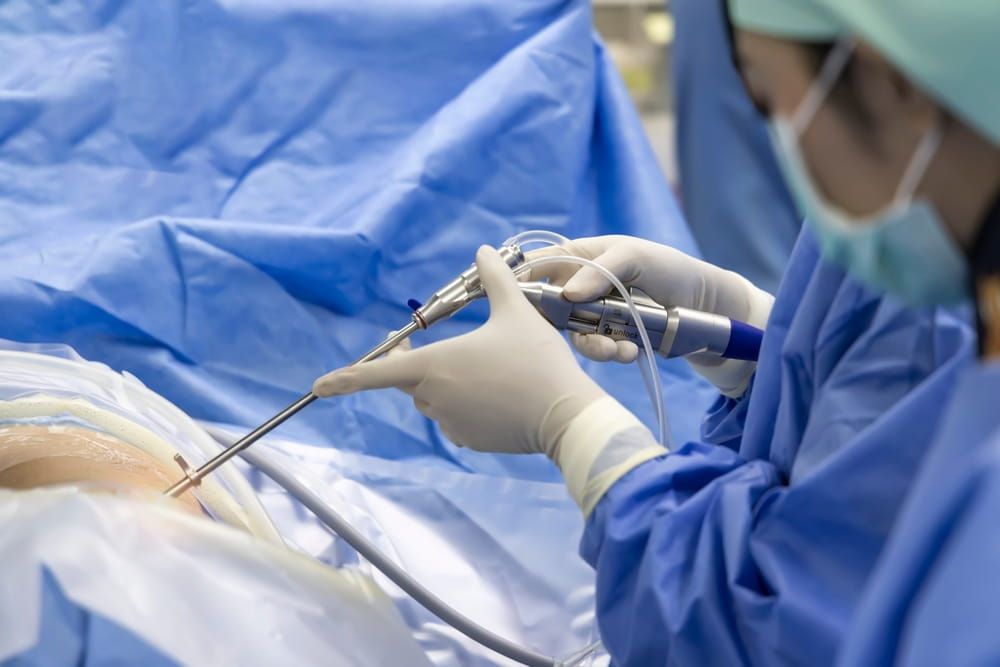 Team of doctor or surgeon and nurse in blue gown inside operating room did minimal invasive spine surgery technology