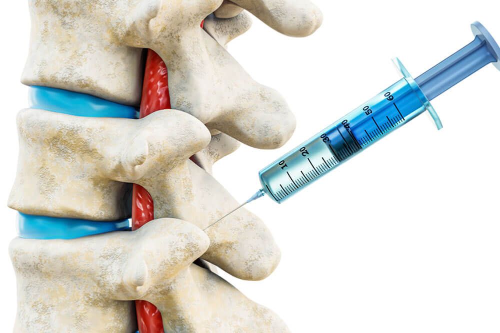 Facet joint injection therapy against backbone injury