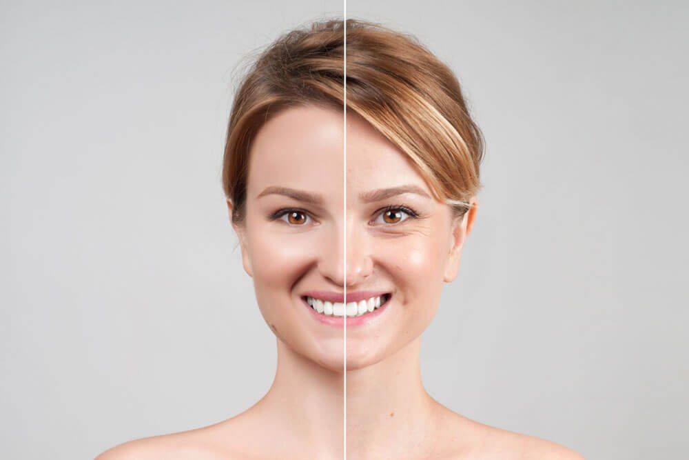 Concept of skin rejuvenation