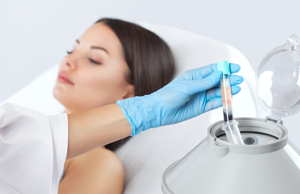 PRP Therapy for Skin Rejuvenation: What to Expect