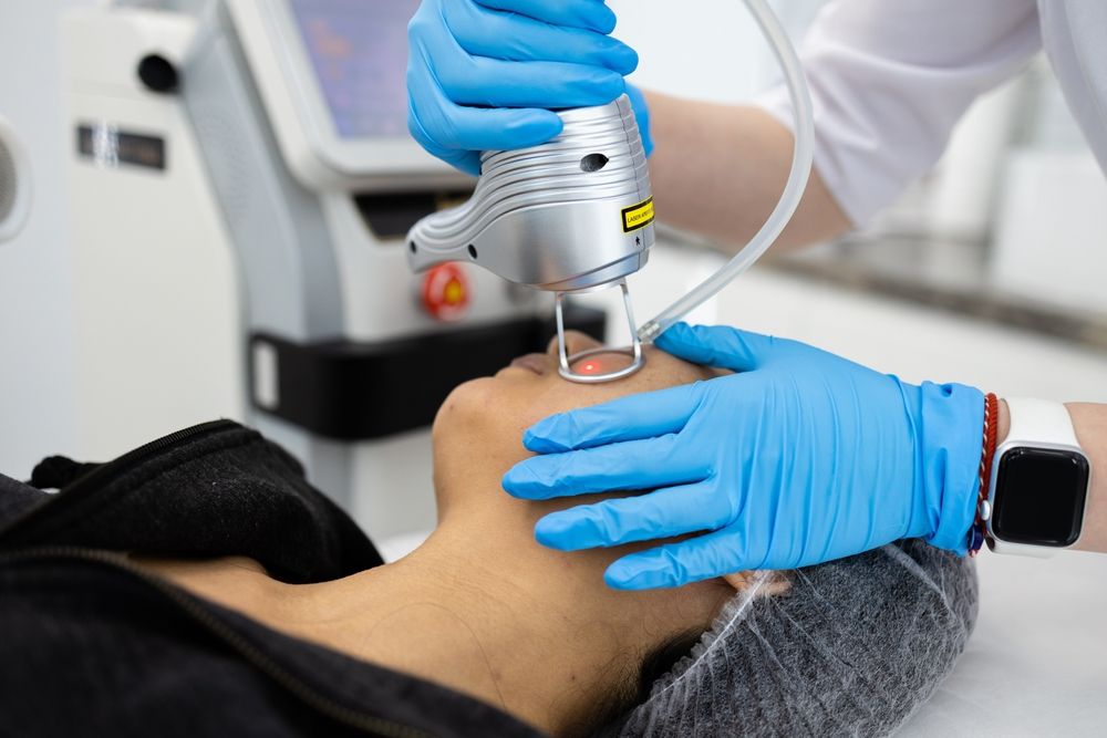 Laser Skin Resurfacing treatment