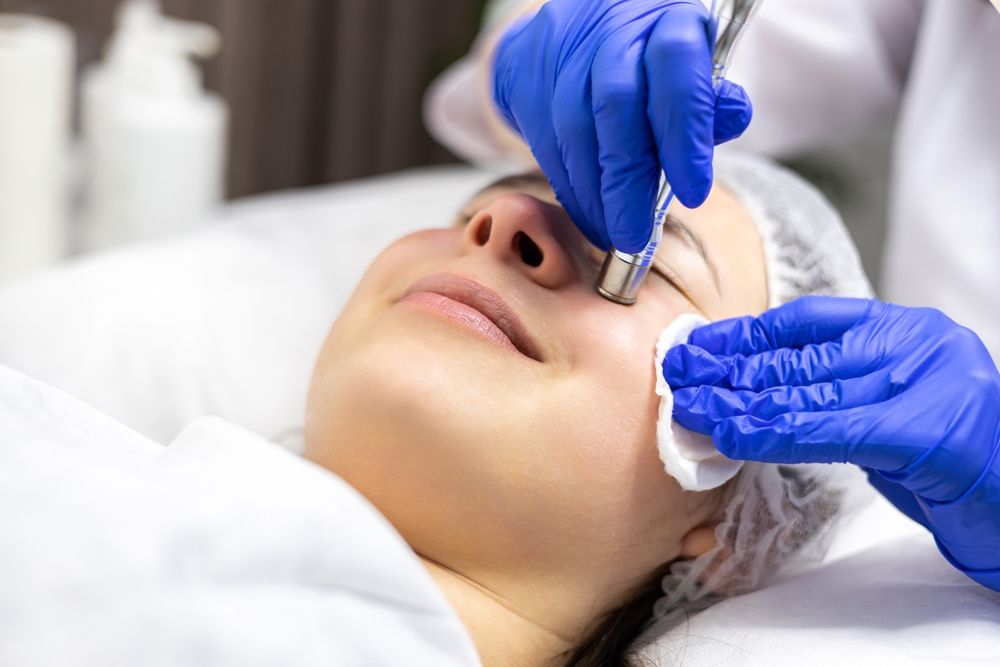 Microdermabrasion treatment