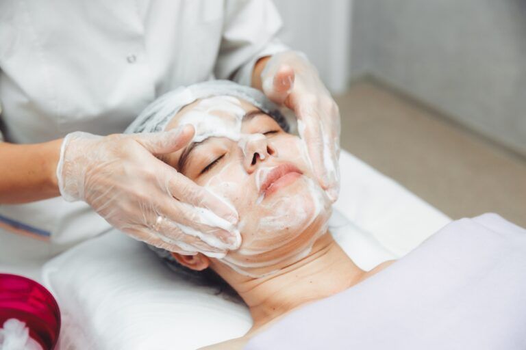 Chemical Peels for Acne-Prone Skin: How They Work