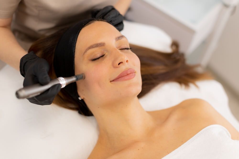 Microneedling