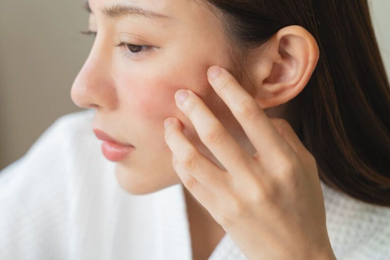 woman touching her face that has dry skin
