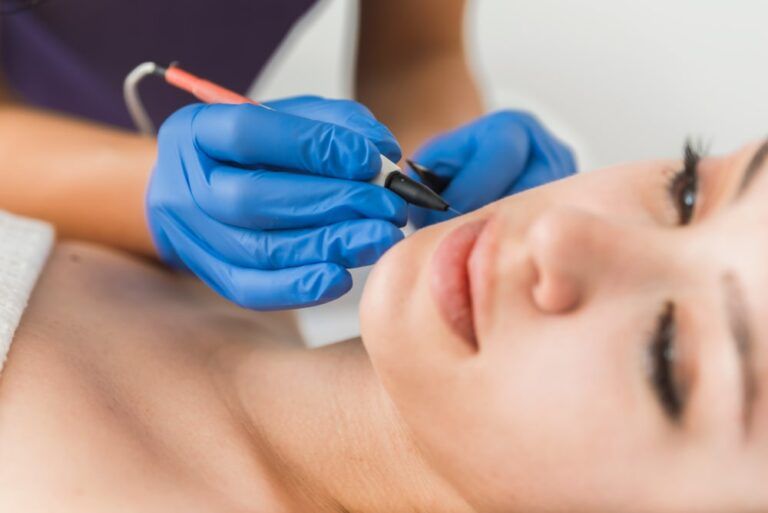 nurse removing unwanted hair from patients face with electrolysis