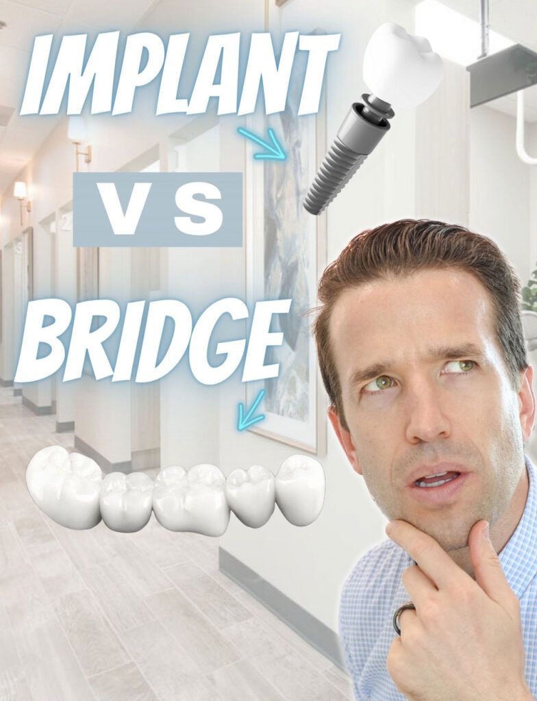 Dental Implant vs. a Bridge