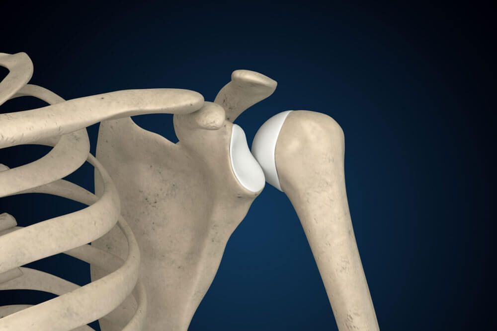 Shoulder Posterior Dislocation 3D Rendering, Shoulder Anatomy