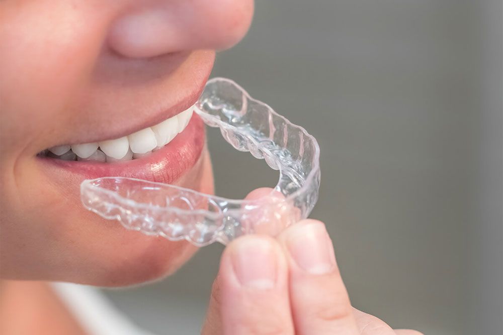 Straight teeth are within reach with Invisalign