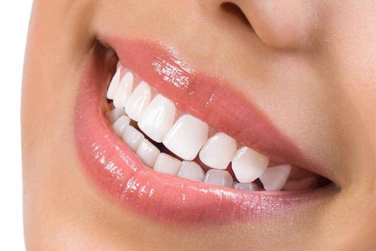 The KöR whitening system and why it works better