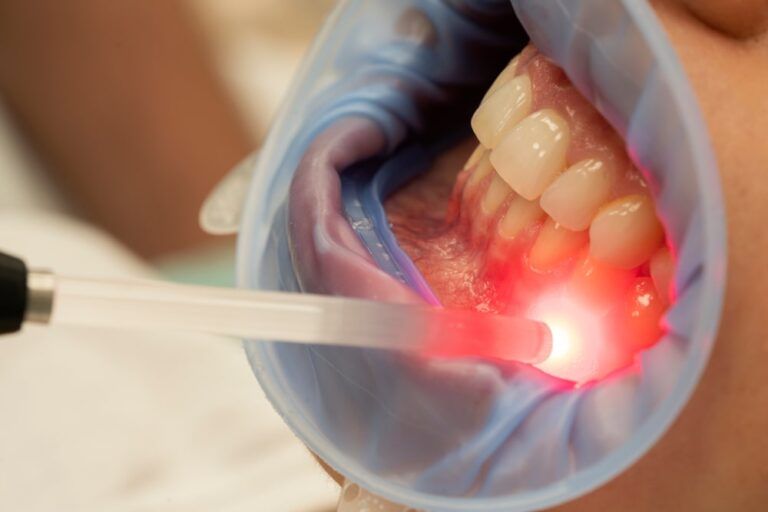 Dental therapy with red light