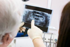 Doctor pointing dental X ray