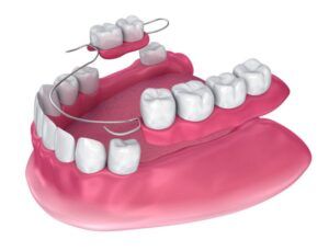 Dentures Concept 3D