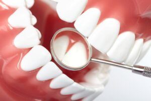 Healthy human teeth and a dentist mouth mirror