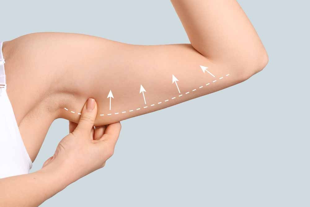 Arm of young woman after slimming