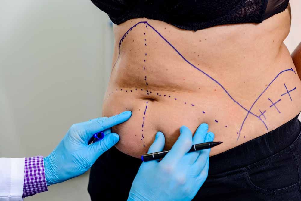 doctor drawing a dashed line on areas of the patient's body