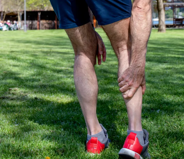 Man's legs with varicose veins while standing on grass