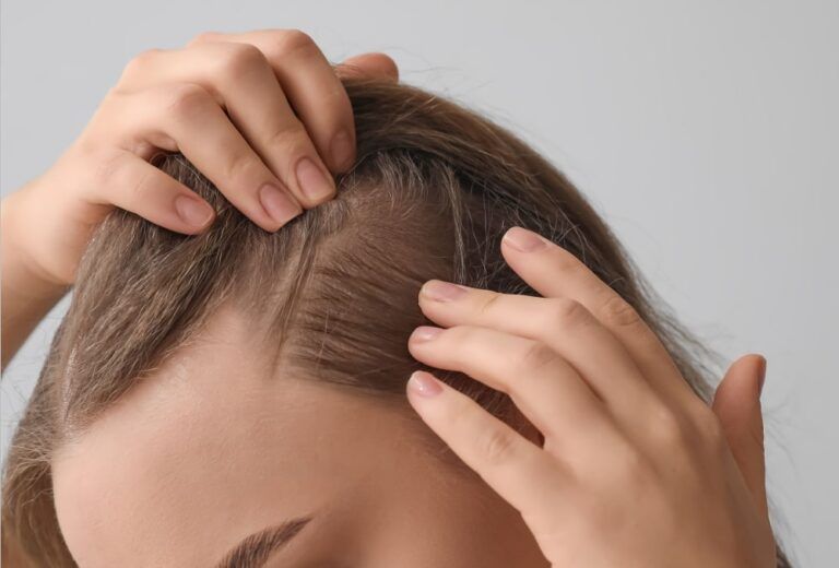 Woman after hair loss treatment