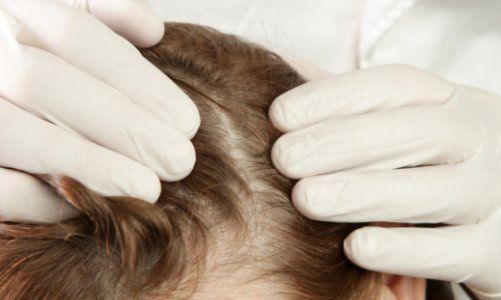 Doctor examining woman's hair scalp