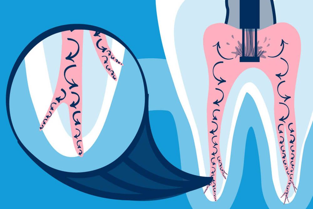 The Endodontic & Periodontic Specialists - Park Plano