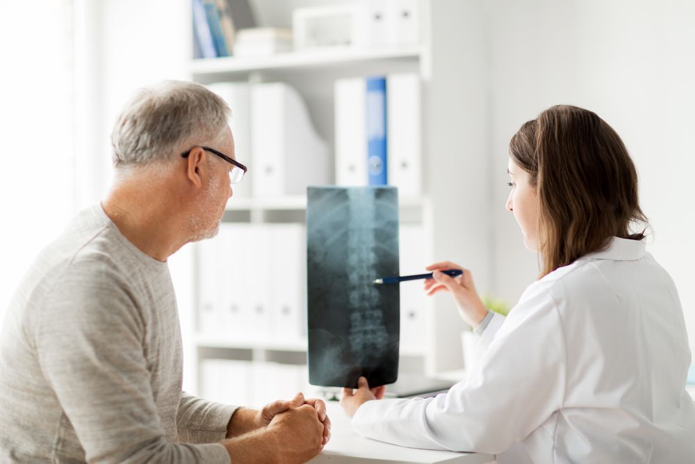 Male Doctor Showing X-ray