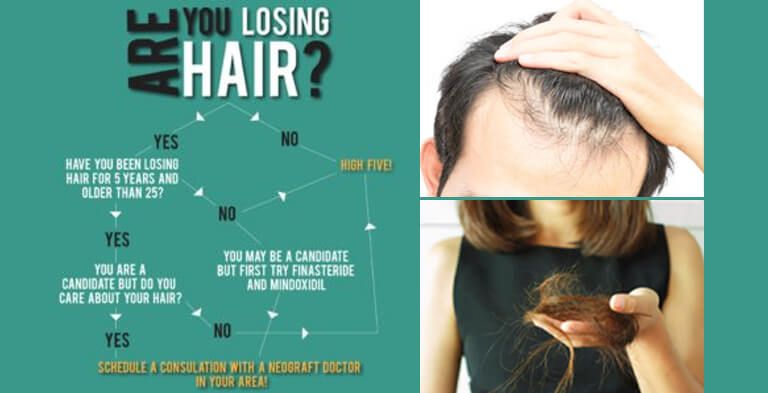 Hair Loss