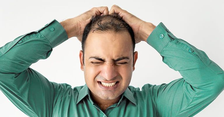 Men in Stress and losing Hairs