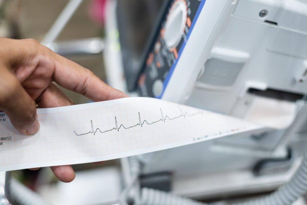 Close up of cardiologist doctor holding and reading ekg paper