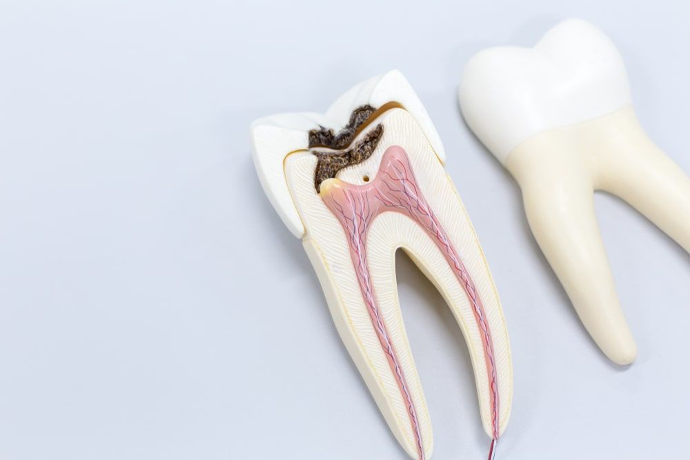 Tooth model for classroom education and in laboratory